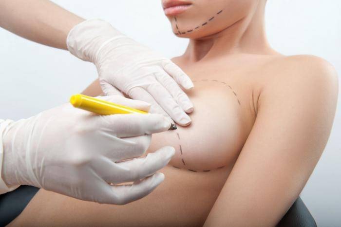 WHY YOU SHOULD OPT FOR BREAST AUGMENTATION?